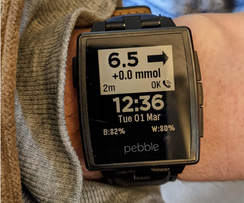 Pebble watches для отображения глюкозы крови